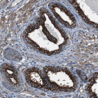 Immunohistochemical staining of human prostate shows strong membranous and cytoplasmic positivity in glandular cells.