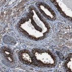 Immunohistochemical staining of human prostate shows strong membranous and cytoplasmic positivity in glandular cells.