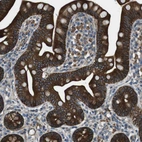 Immunohistochemical staining of human small intestine shows strong membranous and cytoplasmic positivity in glandular cells.