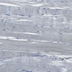 Immunohistochemical staining of human skeletal muscle shows no positivity in myocytes as expected.