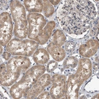 Immunohistochemical staining of human kidney shows moderate cytoplasmic positivity in cells in tubules.