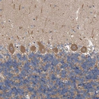 Immunohistochemical staining of human cerebellum shows strong cytoplasmic positivity in Purkinje cells.