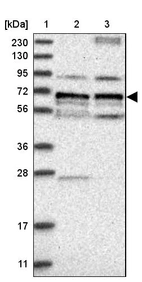 Lane 1: Marker [kDa] 230, 130, 95, 72, 56, 36, 28, 17, 11_br/_Lane 2: Human cell line RT-4_br/_Lane 3: Human cell line U-251MG sp