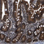Immunohistochemical staining of human duodenum shows strong cytoplasmic positivity in glandular cells.