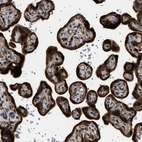 Immunohistochemical staining of human placenta shows strong cytoplasmic positivity in trophoblastic cells.