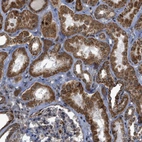 Immunohistochemical staining of human kidney shows strong cytoplasmic positivity in cells in tubules.