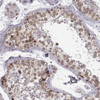Immunohistochemical staining of human testis shows strong positivity in nuclear membrane in cells in seminiferous ducts.