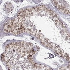 Immunohistochemical staining of human testis shows strong positivity in nuclear membrane in cells in seminiferous ducts.