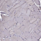 Immunohistochemical staining of human skeletal muscle shows no positivity in myocytes as expected.