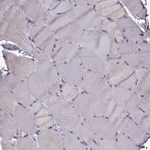 Anti-TSPYL5 Antibody