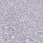 Immunohistochemical staining of human liver shows no positivity in hepatocytes as expected.