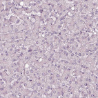 Immunohistochemical staining of human liver shows no positivity in hepatocytes as expected.