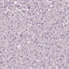 Immunohistochemical staining of human liver shows no positivity in hepatocytes as expected.