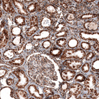 Immunohistochemical staining of human kidney shows strong granular cytoplasmic positivity in cells in tubules.
