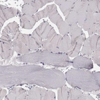 Immunohistochemical staining of human skeletal muscle shows no positivity in myocytes as expected.