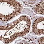 Immunohistochemical staining of human testis shows moderate to strong nuclear positivity in cells in seminiferous ducts.