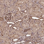 Immunohistochemical staining of human kidney shows strong nuclear-cytoplasmic positivity in cells in glomeruli and moderate nucleus-cytoplasmic positivity in cells in tubules.
