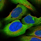 Immunofluorescent staining of human cell line U-2 OS shows localization to nucleoli & cytosol.