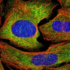 Immunofluorescent staining of human cell line U-2 OS shows localization to cytosol.