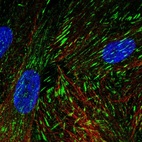 Anti-LIMS2 Antibody