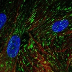 Immunofluorescent staining of human cell line BJ shows localization to focal adhesion sites.
