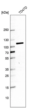 Western blot analysis in human cell line TD47D.