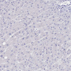 Anti-LRRC37A Antibody