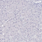 Immunohistochemical staining of human liver shows no positivity in hepatocytes as expected.