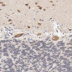 Immunohistochemical staining of human cerebellum shows strong cytoplasmic positivity in Purkinje cells.