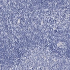 Immunohistochemical staining of human lymph node shows no positivity in non-germinal center cells as expected.