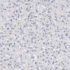 Immunohistochemical staining of human liver shows no positivity in hepatocytes as expected.