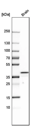Western blot analysis in human brain tissue.