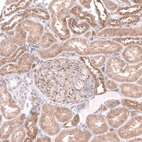 Immunohistochemical staining of human kidney shows moderate cytoplasmic positivity in cells in tubules.