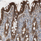 Anti-SPINT1 Antibody