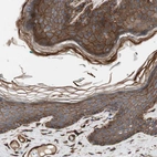 Immunohistochemical staining of human skin shows strong membranous and cytoplasmic positivity in squamous epithelial cells.