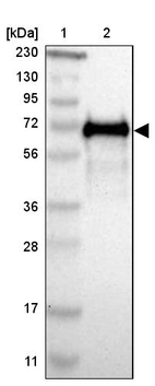 Lane 1: Marker [kDa] 230, 130, 95, 72, 56, 36, 28, 17, 11_br/_Lane 2: Human cell line RT-4