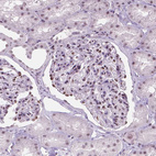Immunohistochemical staining of human kidney shows moderate nuclear positivity in cells in glomeruli.