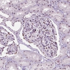 Immunohistochemical staining of human kidney shows moderate nuclear positivity in cells in glomeruli.