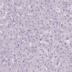 Immunohistochemical staining of human liver shows no positivity in hepatocytes as expected.