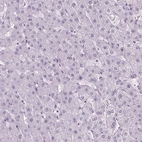 Immunohistochemical staining of human liver shows no positivity in hepatocytes as expected.