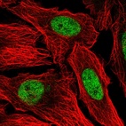 Immunofluorescent staining of human cell line U-2 OS shows localization to nucleoplasm.