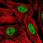 Immunofluorescent staining of human cell line U-2 OS shows localization to nucleoplasm.