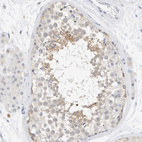 Immunohistochemical staining of human testis shows weak cytoplasmic positivity in cells in seminiferous ducts.