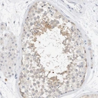 Immunohistochemical staining of human testis shows weak cytoplasmic positivity in cells in seminiferous ducts.