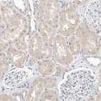Immunohistochemical staining of human kidney shows moderate cytoplasmic positivity in cells in tubules.