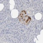 Immunohistochemical staining of human pancreas shows strong cytoplasmic positivity in islets of Langerhans.