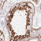 Immunohistochemical staining of human testis shows strong cytoplasmic positivity in cells in seminiferous ducts.