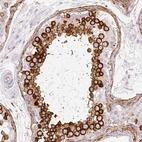 Immunohistochemical staining of human testis shows strong cytoplasmic positivity in cells in seminiferous ducts.