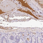 Immunohistochemical staining of human duodenum shows strong positivity in plasma.