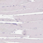 Immunohistochemical staining of human skeletal muscle shows no positivity in myocytes as expected.